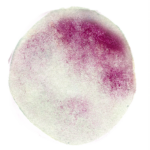 Nasennebenhöhlen – beschwerden