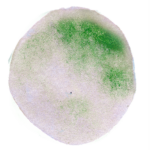 Bei Schulterschmerzen